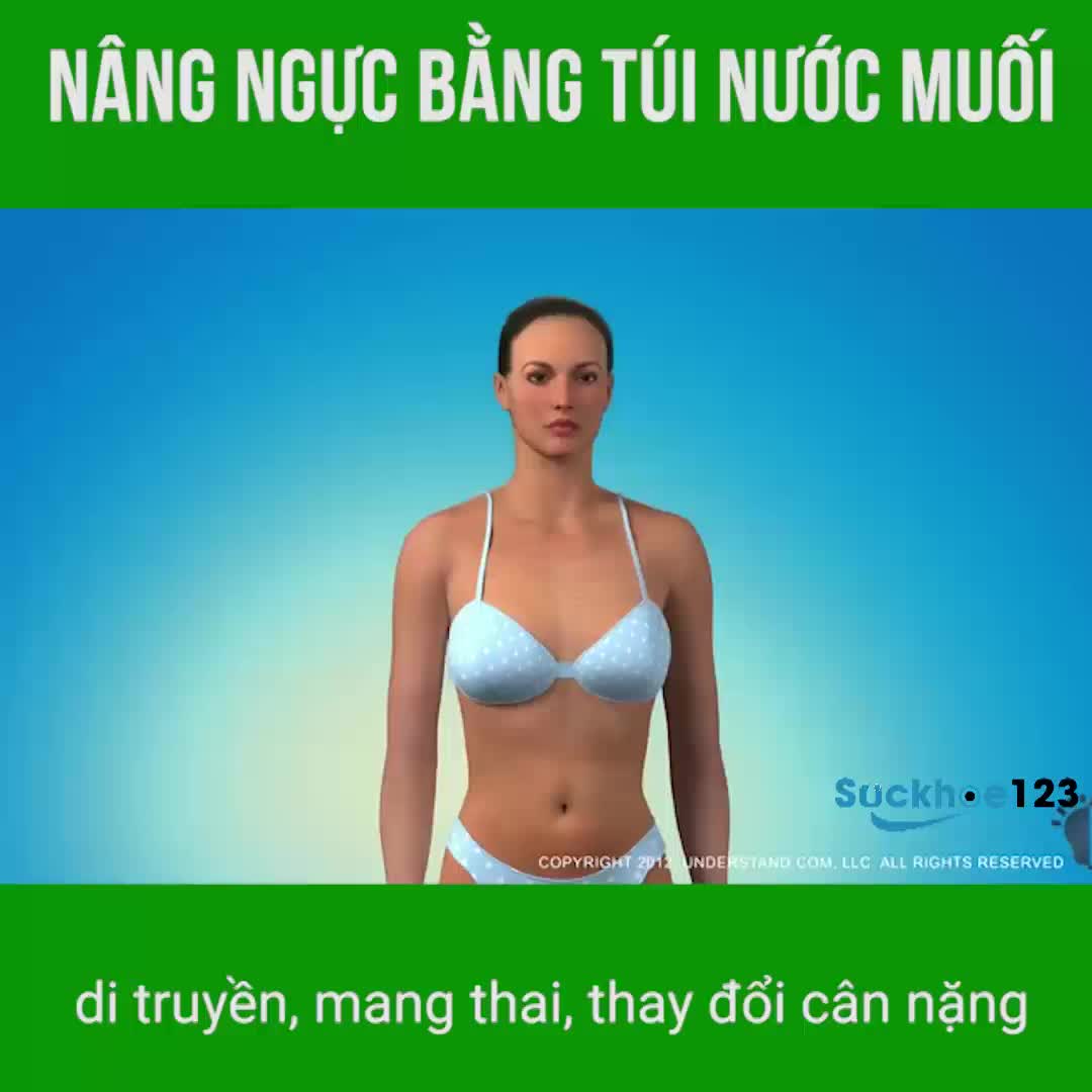 Nâng ngực bằng túi nước muối - Dr Tâm