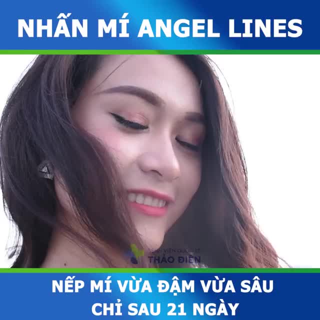 21 NGÀY SAU NHẤN MÍ ANGEL LINES - MẮT ĐẸP NHƯ Ý THỎA SỨC SELFIE