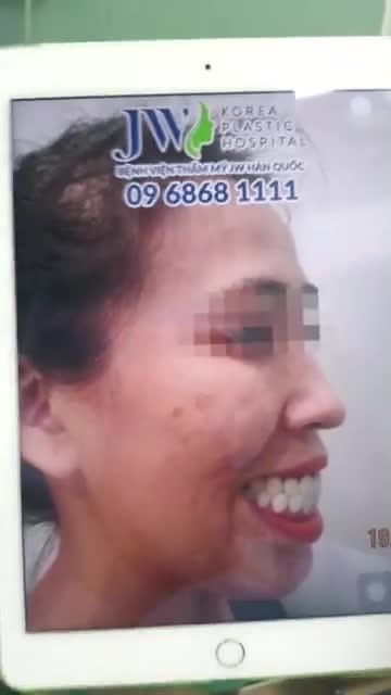 CÔ GÁI HÀM HÔ VÀ CÁI KẾT SAU KHI "THAY ĐỔI SỐ PHẬN" TẠI BỆNH VIỆN JW