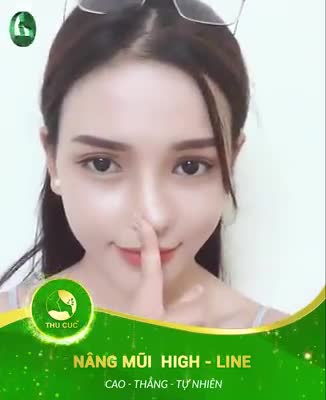 Dáng mũi cao tây tự nhiên chỉ sau 7 ngày