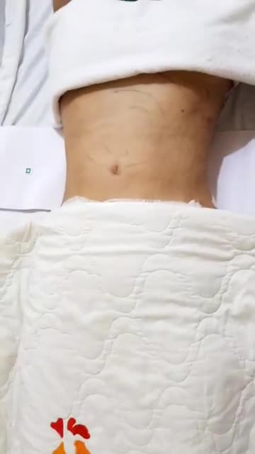 Về dáng "thần tốc" với Tạo hình Body S-Line