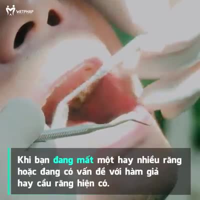CẤY GHÉP IMPLANT – PHỤC HÌNH RĂNG MẤT, HOÀN THIỆN NỤ CƯỜI