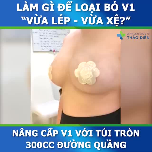 KHẮC PHỤC NHANH CHÓNG TÌNH TRẠNG NHỎ + XỆ
