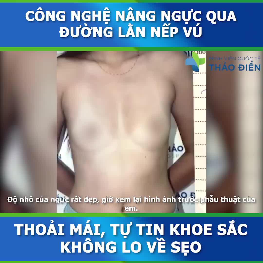 LINH HOẠT SIZE TÚI - KHẮC PHỤC TRIỆT ĐỂ TÌNH TRẠNG NGỰC TO NHỎ KHÔNG ĐỀU NHAU