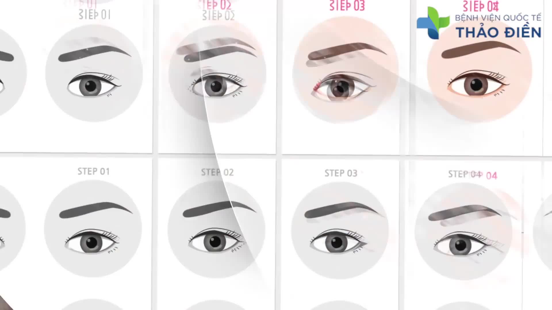 MẮT TO TRÒN LONG LANH NHỜ MỞ RỘNG GÓC MẮT
