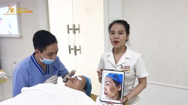NÁM HỖN HỢP KHÓ CHỮA ĐẾN ĐÂU CŨNG HẾT SẠCH SAU 5 BUỔI MELAS PICOSURE .