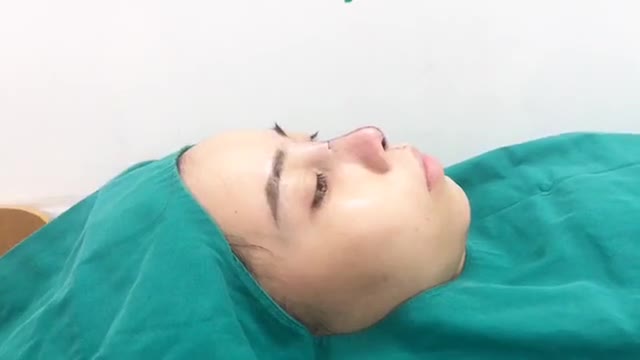 NÂNG MŨI BỌC SỤN KẾT HỢP BỌC CÂN THÁI DƯƠNG