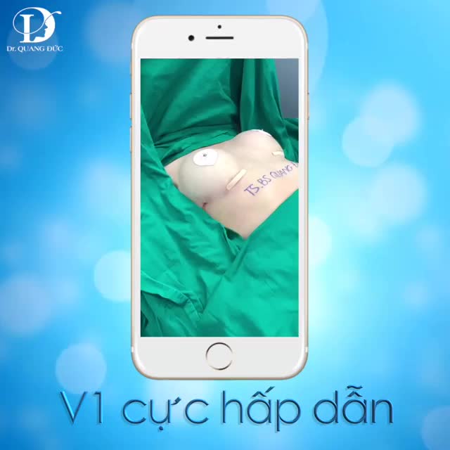 NGỰC LÊN FORM ĐẸP HOÀN HẢO NGAY SAU KHI LÀM DƯỚI TAY NGHỀ CỦA TS.BS QUANG ĐỨC