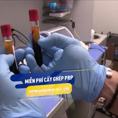 TRỒNG RĂNG IMPLANT 4S  CHỈ TỪ 14.4 TRIỆU