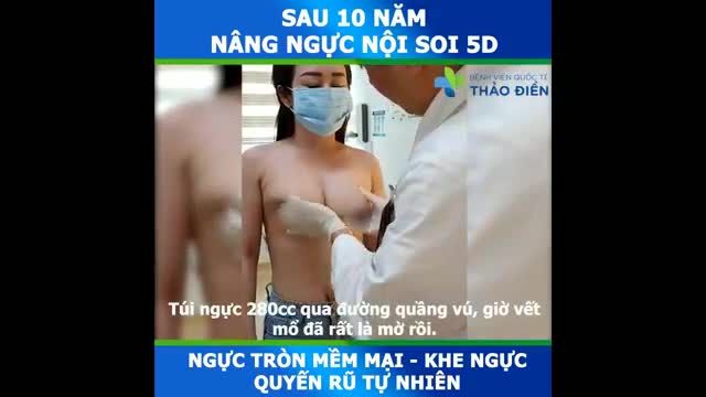 SAU 10_NĂM NÂNG NGỰC – VẪN ĐẸP VẸN NGUYÊN NHƯ NGÀY ĐẦU