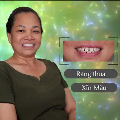 2 LÝ DO ĐẶC BIỆT ĐÃ GIÚP CHỊ LIÊN LẤY LẠI NỤ CƯỜI TỰ TIN
