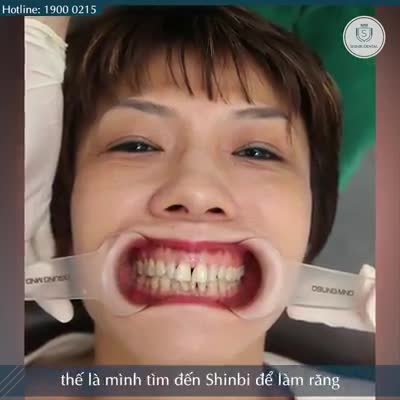 TÔI ĐÃ KHÔNG THỂ ĂN NÓNG UỐNG LẠNH CHO ĐẾN KHI ĐẾN SHINBI