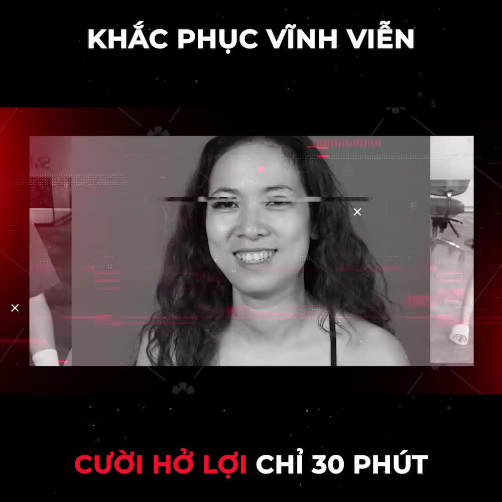 CƯỜI HỞ LỢI GIẢI PHÁP ĐIỀU TRỊ SMILE UP