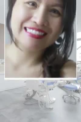 CHIA TAY" HÀM RĂNG PHỦ COMPOSITE DÀY CỘP