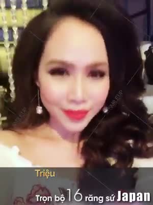 DUY NHẤT CHỈ TRONG THÁNG 4 NÀY
28 TRIỆU trọn bộ 16 răng sứ JAPAN tại Smile Up