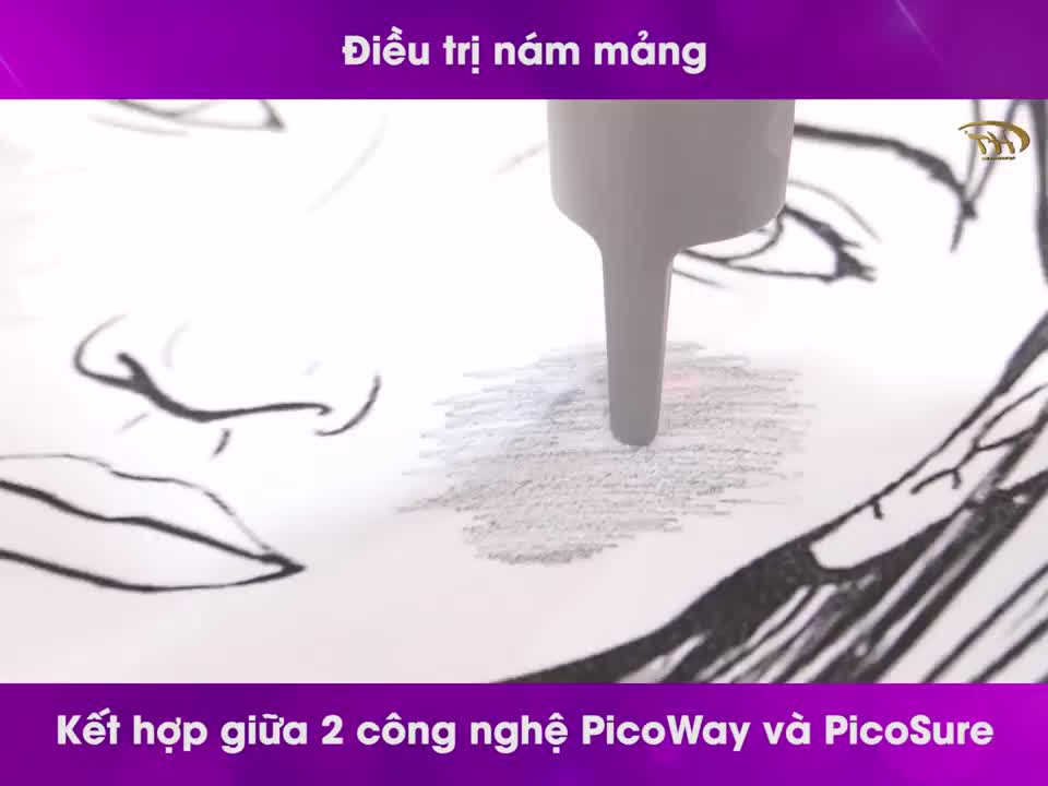 Một thí nghiệm ĐẶC BIỆT: Ảo thuật trị nám