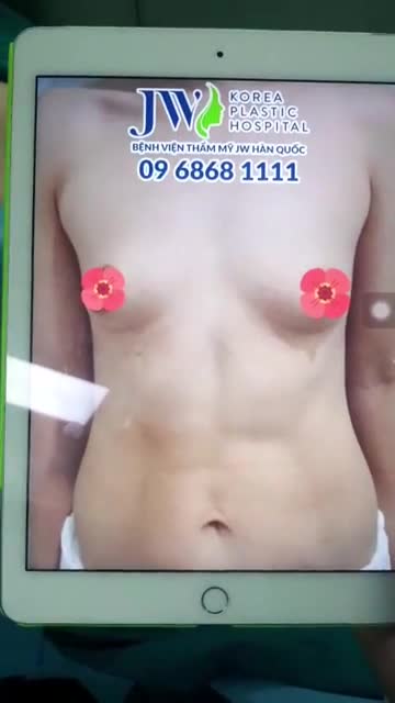 THOÁT KIẾP 2 LƯNG VÀ HÀNH TRÌNH NÂNG CẤP VÒNG 1 CHỈ SAU 60 PHÚT