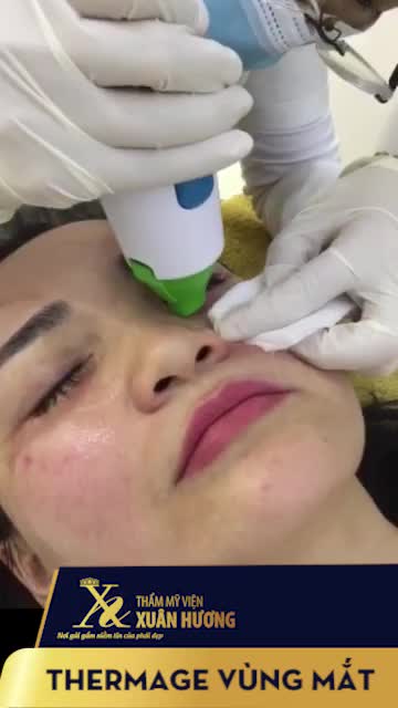 XÓA NHĂN MẮT MÀ CỨ NHẸ NHÀNG NHƯ KHÔNG, 30 PHÚT TRẺ RA CẢ CHỤC TUỔI
