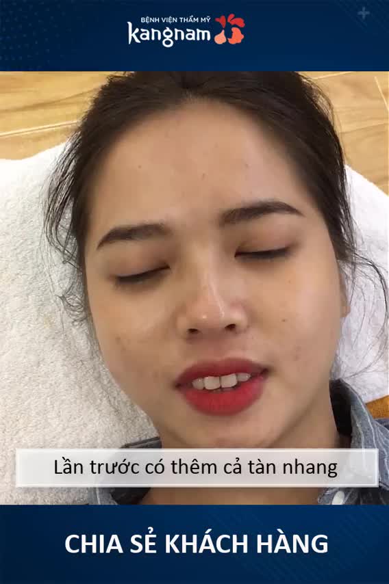 Chỉ 1 tuần điều trị đã không còn thấy dấu vết tàn nhang đâu