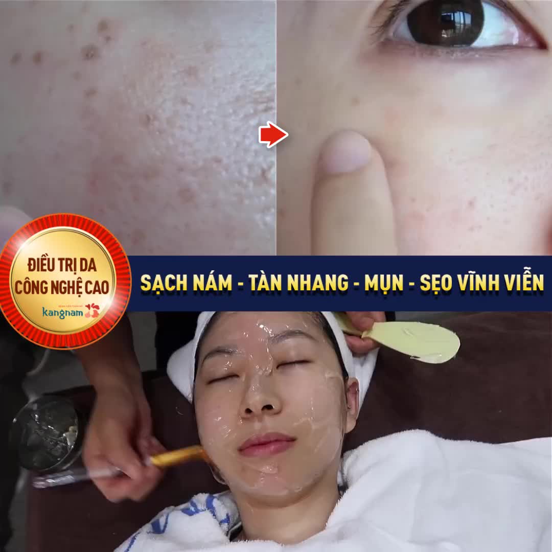 Điều trị da Công nghệ cao - Trị tận gốc