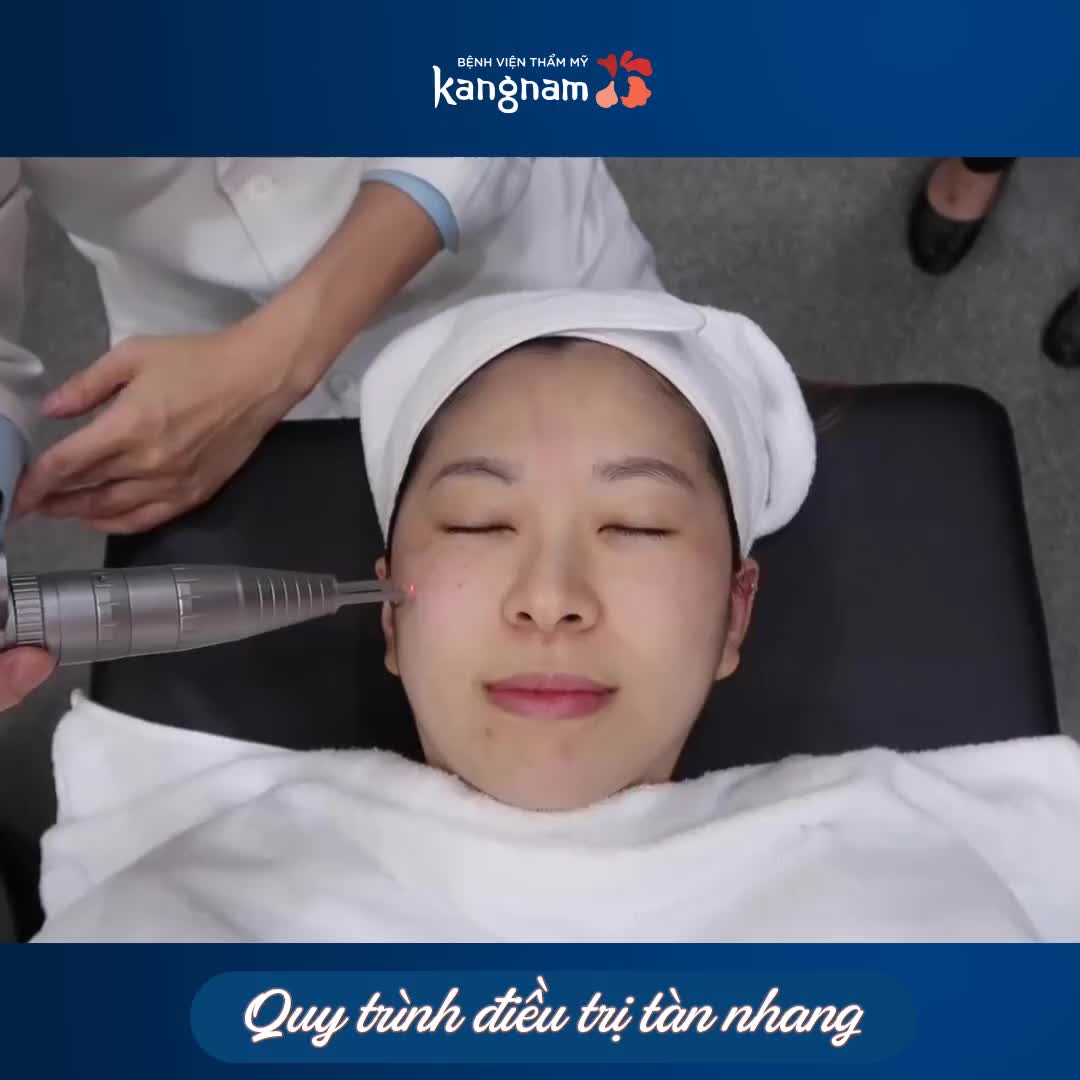 Hé lộ toàn bộ quá trình trị tàn nhang với Laser Picosure