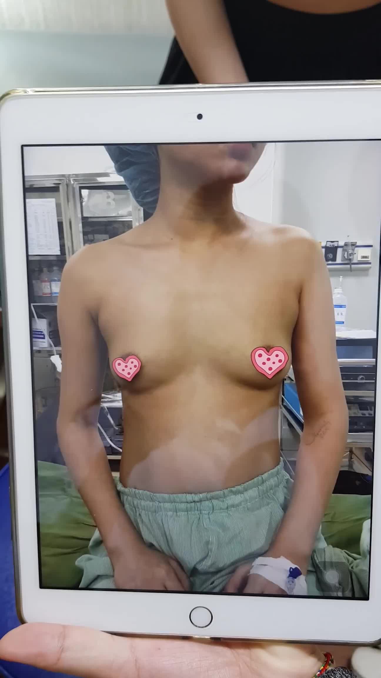 V1 đẹp hoàn hảo sau khi cắt chỉ