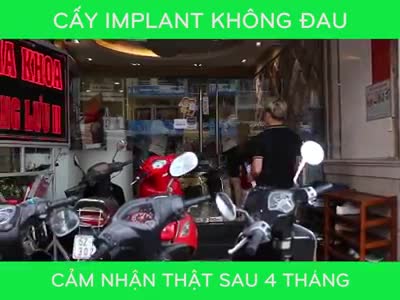 IMPLANT KHÔNG ĐAU  PHỤC HỒI CHỨC NĂNG ĂN NHAI  PHỤC HỒI THẨM MỸ
