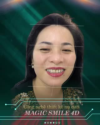Muốn tự tin trong giao tiếp, cách đơn giản nhất là thay đổi nụ cười