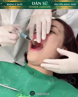 QUY TRÌNH DÁN VENEER TẠI NHA KHOA GIA ĐÌNH