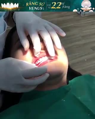 TRƯỚC ĐÂY MỖI LẦN CƯỜI MÌNH KHÔNG BAO GIỜ ĐỂ NGƯỜI KHÁC NHÌN THẤY RĂNG CỦA MÌNH