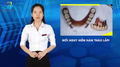 MỐI NGUY HIỂM HÀM THÁO LẮP