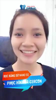 Hoại Tử Chân Răng Do Làm cầu 3R Sứ Tại Nha Khoa Khác