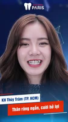 02 NGÀY Răng Hết Thưa - Hô - Khấp Khểnh Hơn 75000 KH hài lòng với NỤ CƯỜI NHƯ Ý