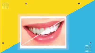 NHỮNG ĐIỀU CẦN BIẾT TRƯỚC KHI TẨY TRẮNG RĂNG