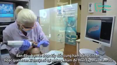 QUY TRÌNH CHỈNH NHA INVISALIGN NHƯ THẾ NÀO