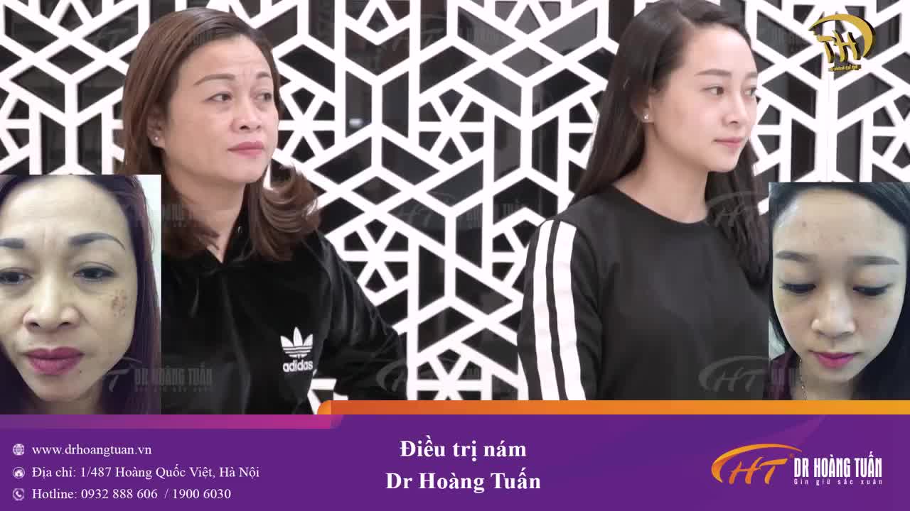 HAI MẸ CON CÙNG TRẺ - ĐẸP SAU TRỊ NÁM!