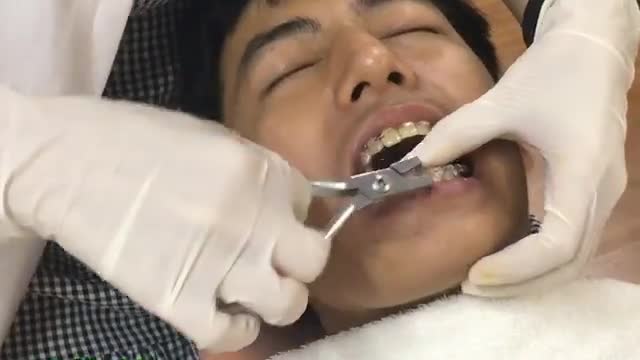 THÁO MẮC CÀI