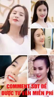 Sale Sập Sàn, chào hè rạng rỡ với nụ cười tỏa sáng chỉ 23 triệu - Trọn bộ 16 răng sứ ???????? ??