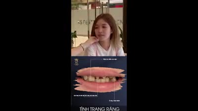 KHÔI PHỤC NỤ CƯỜI DỄ THƯƠNG