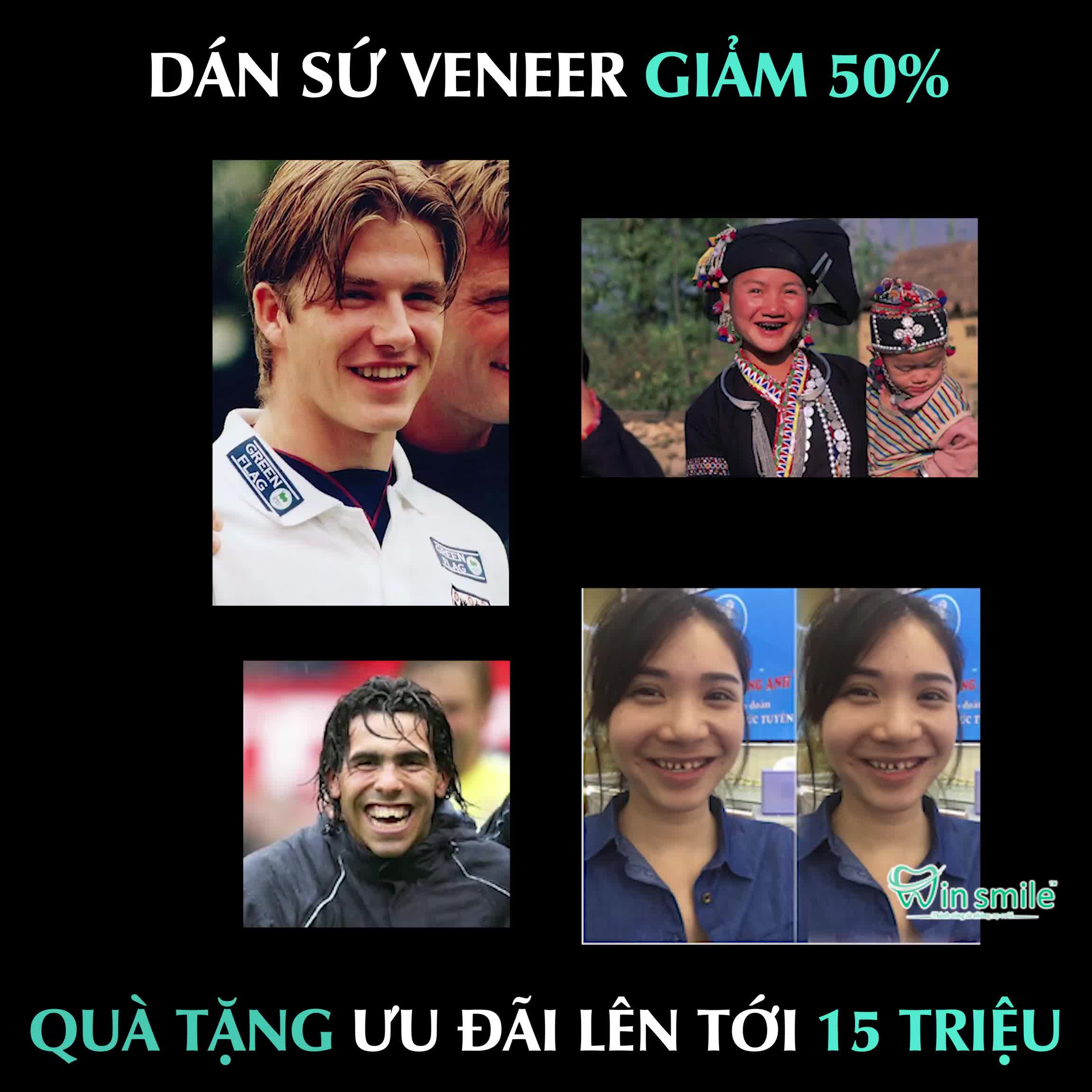 DÁN SỨ EMAX PRESS CAO CẤP 
IẢM 50% TẶNG QUÀ 15TR