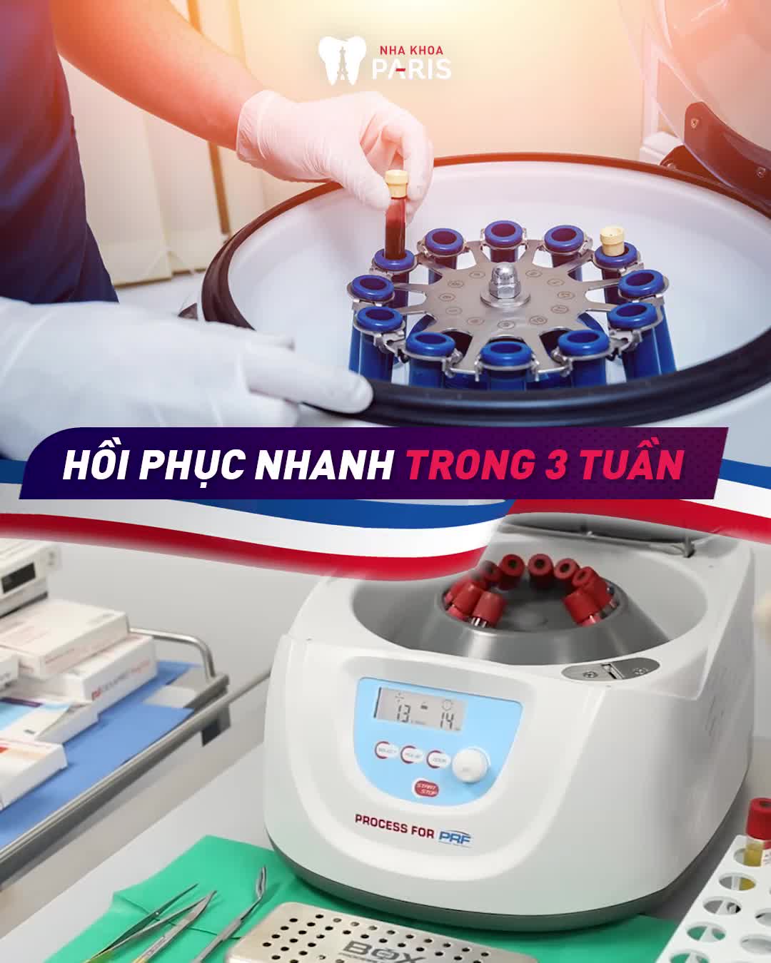 ÔNG BÀ, CHA MẸ BẠN BỊ MẤT RĂNG KHÓ KHĂN TRONG ĂN NHAI, ĂN KHÔNG NGON MIỆNG