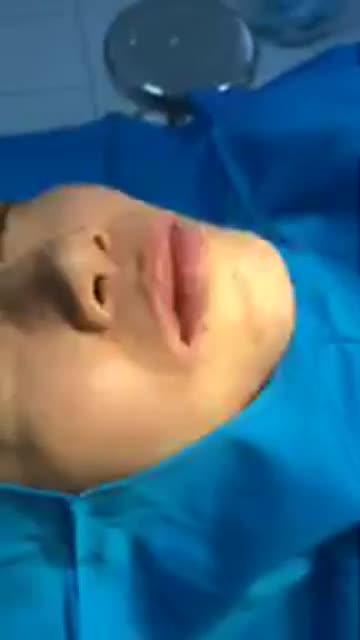 Hoàn thành ca Cười Hở Lợi