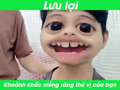 TEAM NIỀNG RĂNG  ĐÂU RỒI