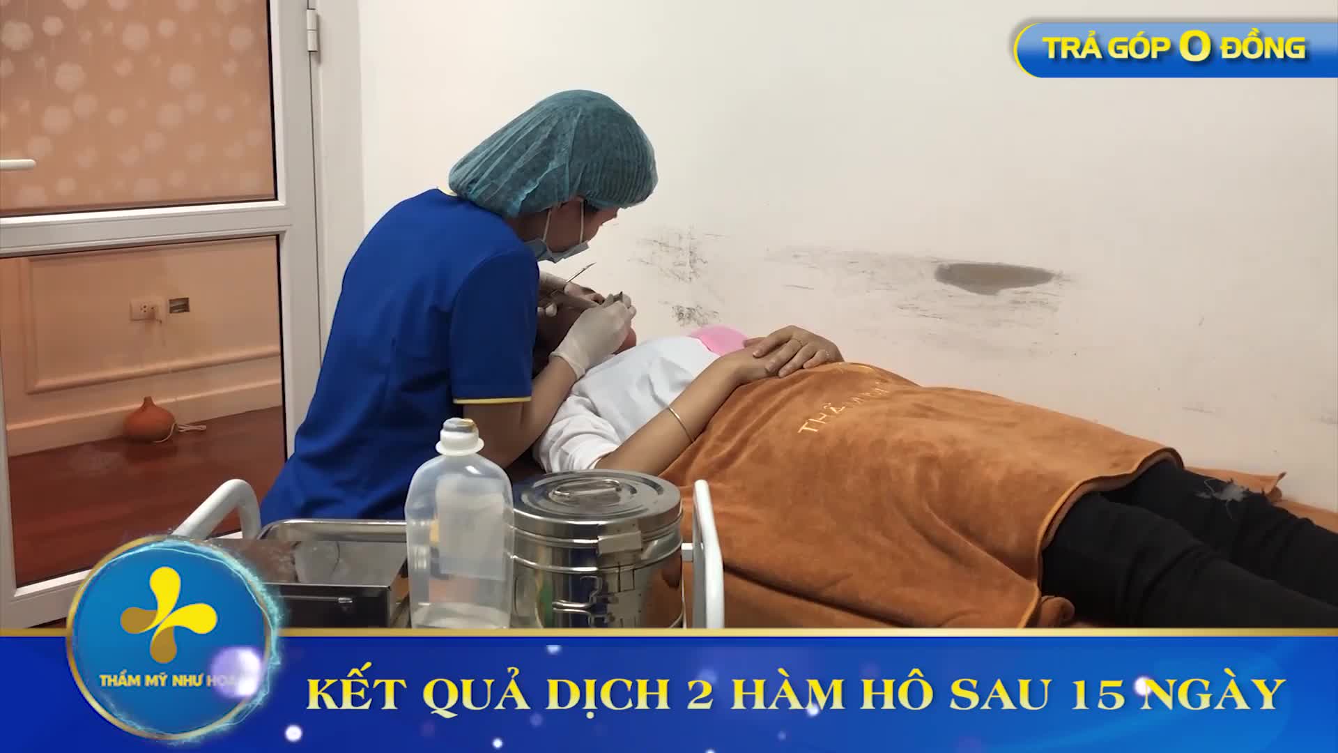 HÓA GIẢI KIẾP HÀM HÔ - THAY ĐỔI NỤ CƯỜI CHO 9X