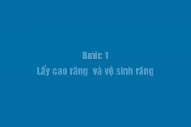 Tẩy trắng răng được thực hiện như thế nào và kết quả ra sao