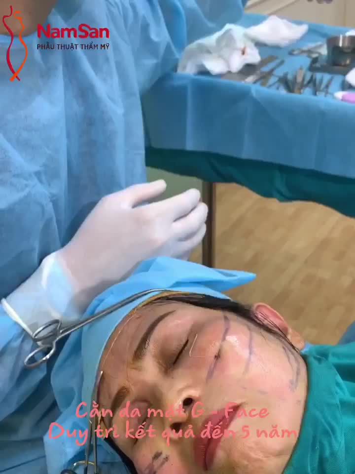 Cận cảnh căng da mặt G - Face
