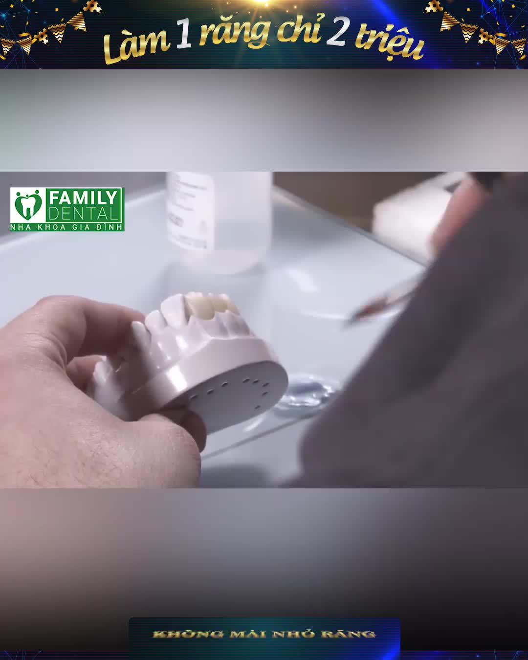 QUY TRÌNH CHẾ TÁC CẦU RĂNG SỨ đạt chuẩn từng mm