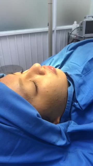 CƯỜI HỞ LỢI