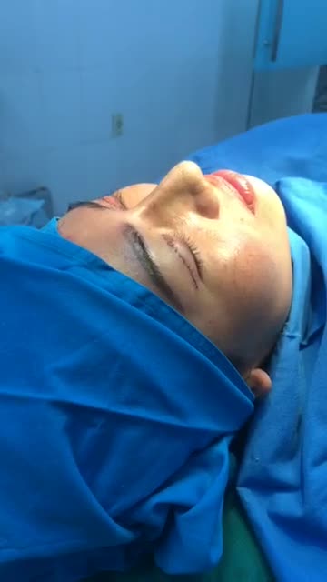 Cắt Mắt Ấn Độ  Đuôi Mắt Phượng