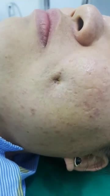 CẮT ĐỒNG TIỀN TÀI LỘC, TÌNH DUYÊN CÙNG BÁC SĨ KỲ